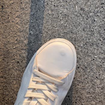 Zara Mağazasından Alınan Ayakkabıda Kısa Sürede Deri Hasarı Yaşadım