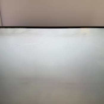 Philips TV'de Devam Eden Ekran Sorunu Ve Yetersiz Servis Çözümü