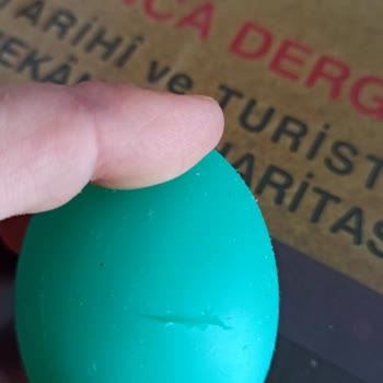 El Egzersiz Topu Kısa Sürede Bozuldu