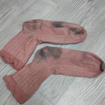 Derimod Ayakkabıdan Boya Geçişi Ve Olumsuz Değişim Deneyimi