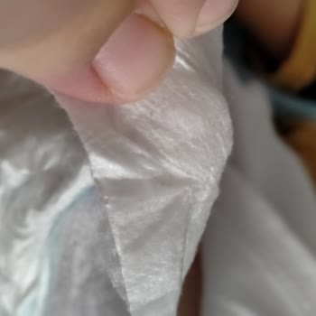 Molfix Bebek Bezinde Sert Jel Sorunu Ve Kullanamama