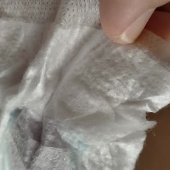 Molfix Bebek Bezinde Sert Jel Sorunu Ve Kullanamama