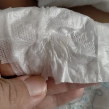 Molfix Bebek Bezinde Sert Jel Sorunu Ve Kullanamama