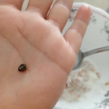 Müsli Paketinden Taş Çıktı, Dişimi Zor Kurtardım