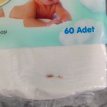 Uni Baby Ürününde Hijyen Sorunu: Pakette Kirli Pamuk Şoku
