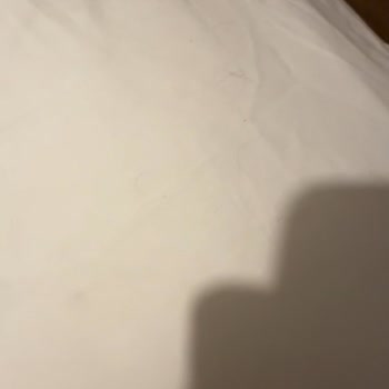 Airbnb'de Kirli Ev Ve Ev Sahibinin Olumsuz Davranışı