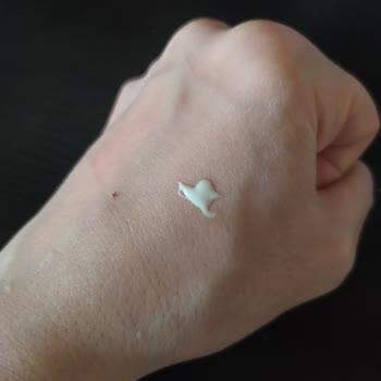 Bioderma Güneş Kremi Bozuk Çıktı, Yüzümde Soyulma Ve Renk Değişimi Yaşadım