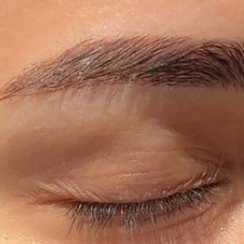 Nurşah Akpınar Beauty Kaş İşleminde Büyük Hayal Kırıklığı Ve Maddi Kayıp