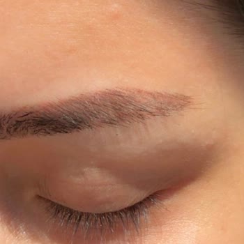 Nurşah Akpınar Beauty Kaş İşleminde Büyük Hayal Kırıklığı Ve Maddi Kayıp