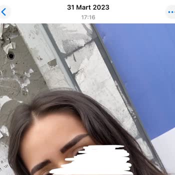 Nurşah Akpınar Beauty Kaş İşleminde Büyük Hayal Kırıklığı Ve Maddi Kayıp