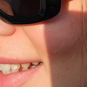 Diş Piercingi Sonrası Taşın Düşmesi Ve İlgisiz Doktor Deneyimi