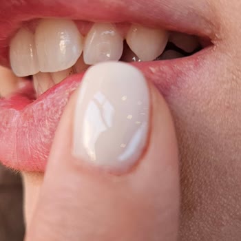 Diş Piercingi Sonrası Taşın Düşmesi Ve İlgisiz Doktor Deneyimi