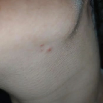 Cosmogenesis Labs Yüzümü Çok Kötü Hale Getirdi