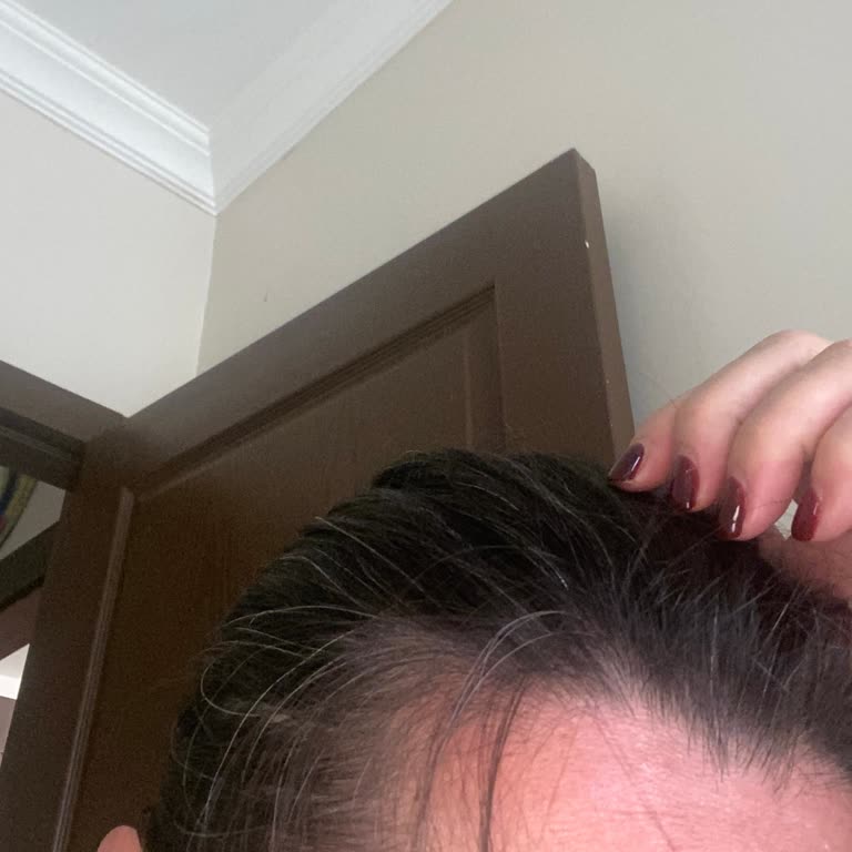 Urban Care Saç Spreyi Sonrası Beyaz Saçlar Ve Hızlı Yağlanma Sorunu