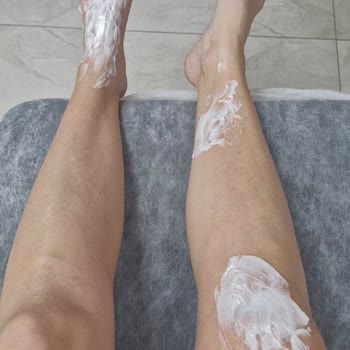 Stanley Termosun Kapağı Patladı, Ayağım Yandı: Acil Dönüş Bekliyorum