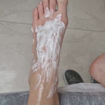 Stanley Termosun Kapağı Patladı, Ayağım Yandı: Acil Dönüş Bekliyorum