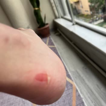 Aldığım Puma Ayakkabı Hatalı Ve Orijinal Değil, Çözüm Bekliyorum