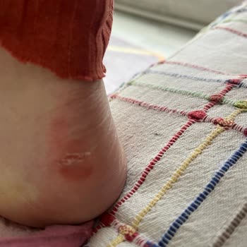 Aldığım Puma Ayakkabı Hatalı Ve Orijinal Değil, Çözüm Bekliyorum