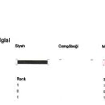 HP Smart Tank 589 Yazıcıda 1 Ayda Arıza Ve Servis Desteği Zorluğu