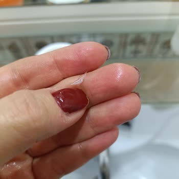 Kremden Çıkan Cam Parçası Elimizi Kesti, Güvenimiz Sarsıldı