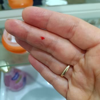 Kremden Çıkan Cam Parçası Elimizi Kesti, Güvenimiz Sarsıldı