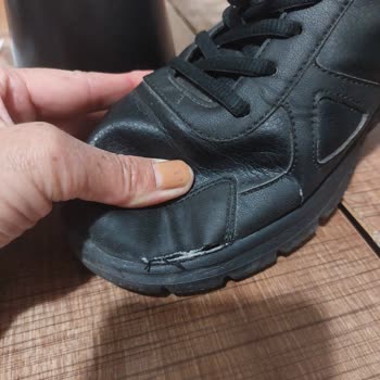 Skechers Ayakkabıda 4 Ayda Açılma Ve Değişim Reddi