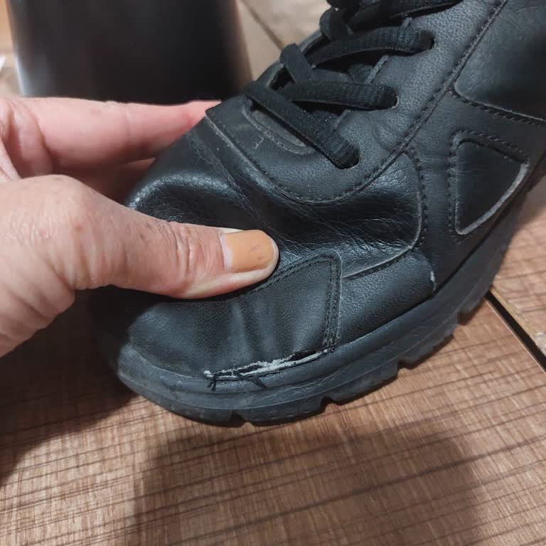 Skechers Ayakkabıda 4 Ayda Açılma Ve Değişim Reddi