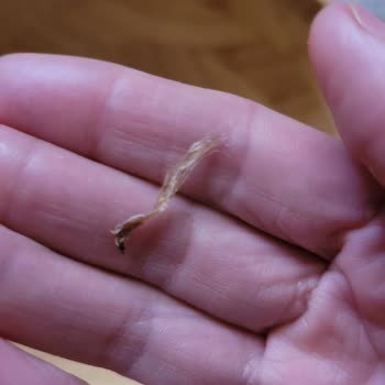 Ruffles Cips Paketinden Yabancı Cisim Çıkması Ve Sağlıksız Üretim