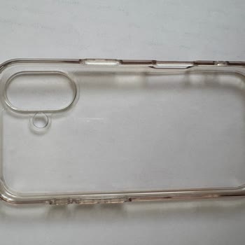 Yüksek Fiyatlı Spigen Kılıfın Hızlı Sararması Ve Garanti Kapsamı Hayal Kırıklığı Yarattı