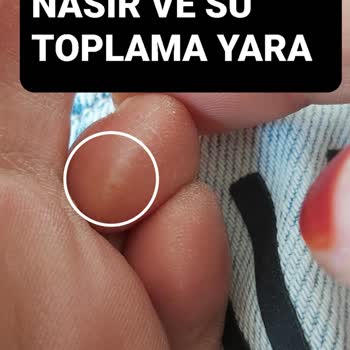 Eki aç