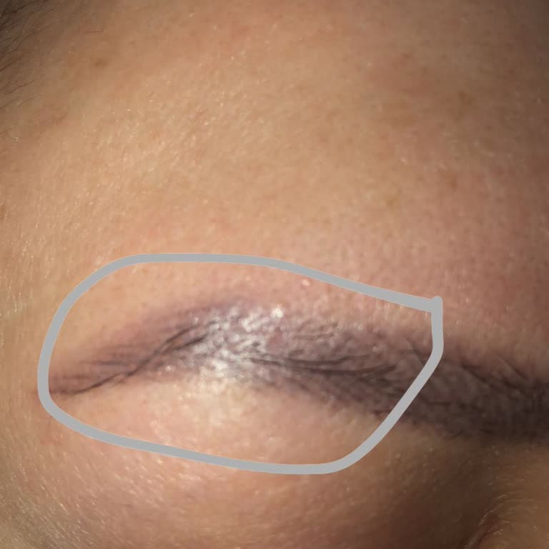 Kelebek Beauty Mağduriyet Yaşama