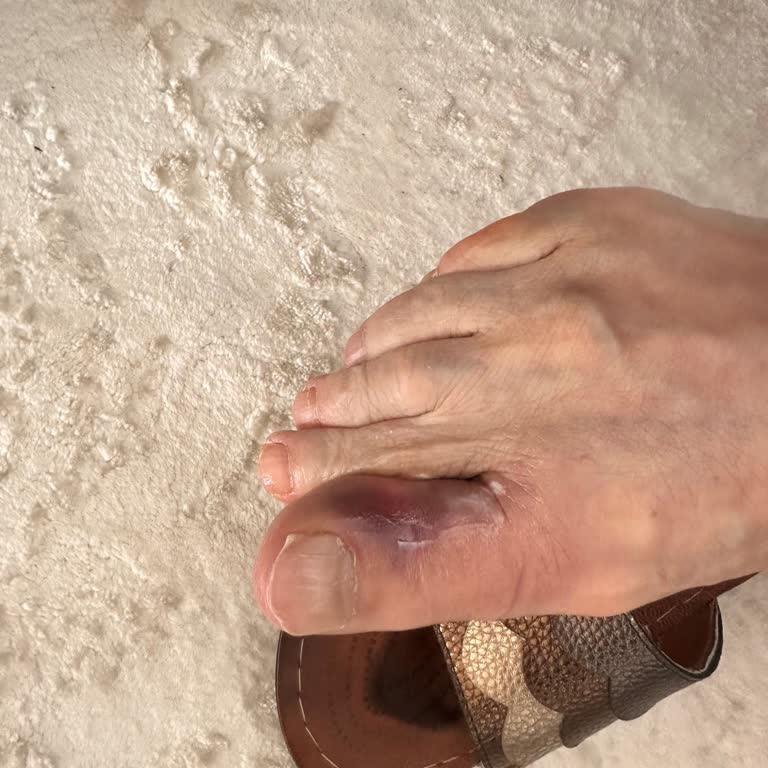 Pegasus Yetersiz Tekerlekli Sandalye Hizmeti Ve İlgisiz Personel Nedeniyle Mağduriyet