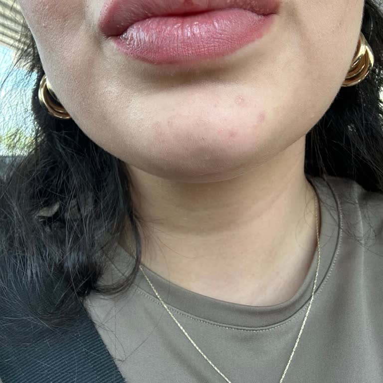 Loreal Infaillible 24hr Ruj Dudağımda Soyulup Çıkıyor