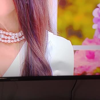 TV Ekranındaki Çizgiler Ve Garanti Kapsamında Yaşanan Sorunlar