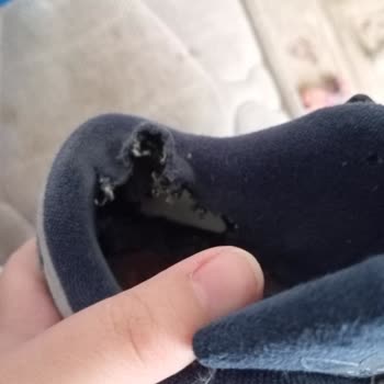 Adidas Forum Ayakkabının Arkası Kısa Sürede Yırtıldı Ve Garanti Reddedildi