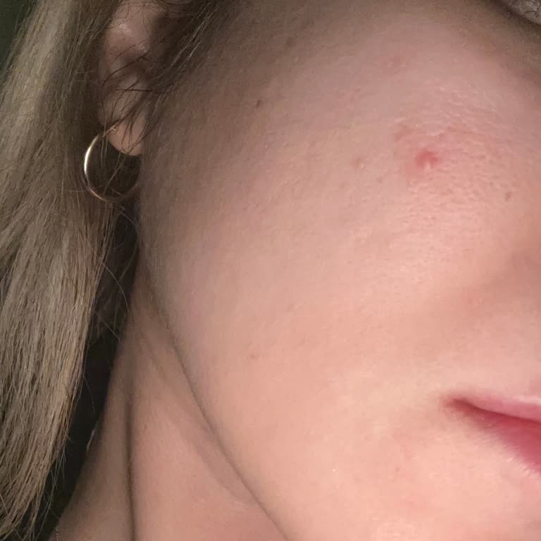 Высыпания от Estee Lauder Advanced Night Repair после использования