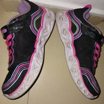 Boyner'den Alınan Skechers Ayakkabıda Hızlı Deformasyon Ve Red Yanıtı