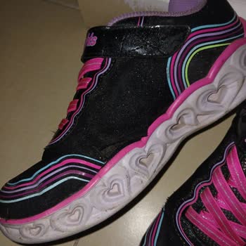 Boyner'den Alınan Skechers Ayakkabıda Hızlı Deformasyon Ve Red Yanıtı