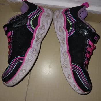 Boyner'den Alınan Skechers Ayakkabıda Hızlı Deformasyon Ve Red Yanıtı