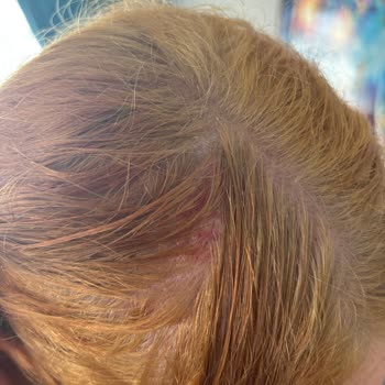 Цвет не держится и проблемы с кожей головы после использования краски для волос Garnier