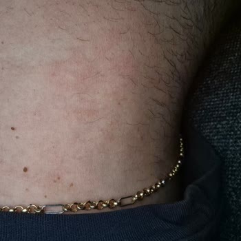 Bargello Parfüm Alerjik Reaksiyona Sebep Oldu