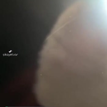 Huawei Ürün Kusurunu Reddetti, Haklı Olarak Yasal Süreç Başlatıyorum!