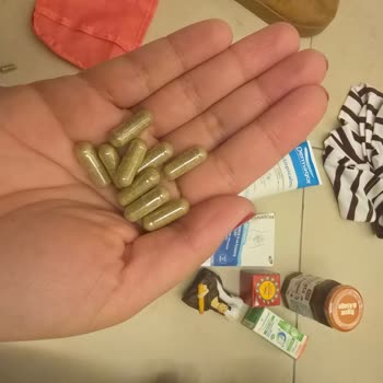 Ajet İle Uçuş Sonrası Kaybolan Eşyalarım