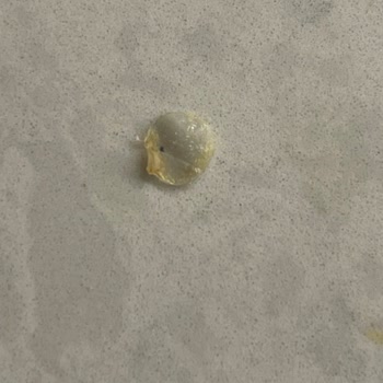 Gedik Piliç Dönerde Kemik Ve Plastik Benzeri Cisim Çıktı, Hijyen Sorunu Yaşadım