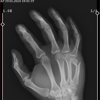 Sigorta Şirketinin Haksız Ödeme Reddi Ve İletişim Sorunu