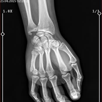 Sigorta Şirketinin Haksız Ödeme Reddi Ve İletişim Sorunu