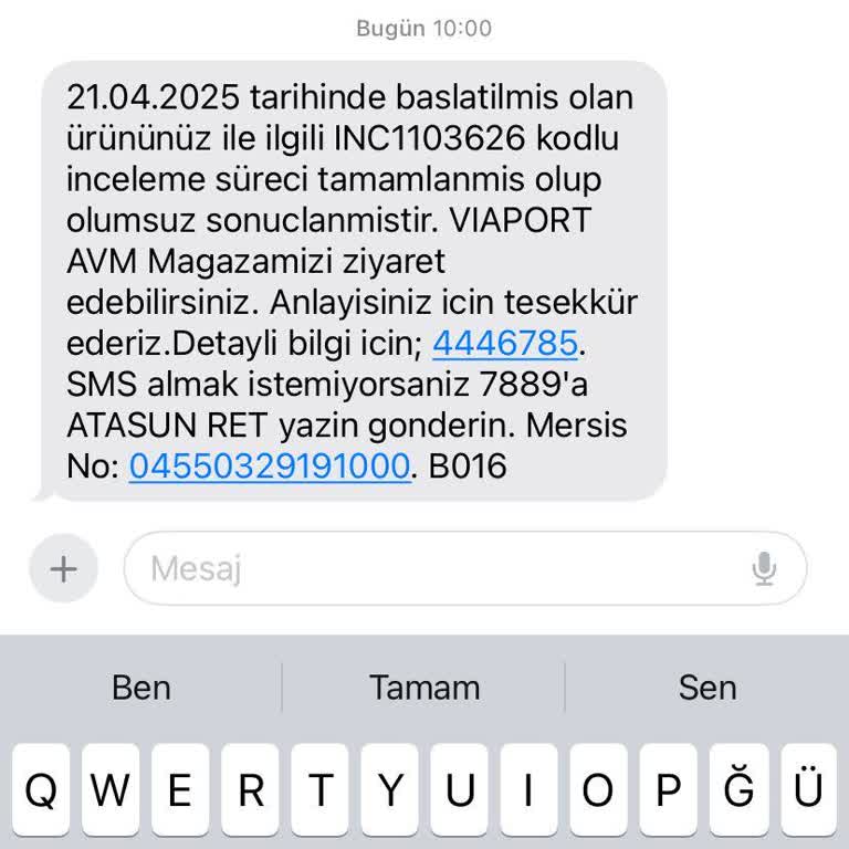 Garanti Kapsamı Dışında Bırakılan Rayban Gözlükte Soyulma Sorunu
