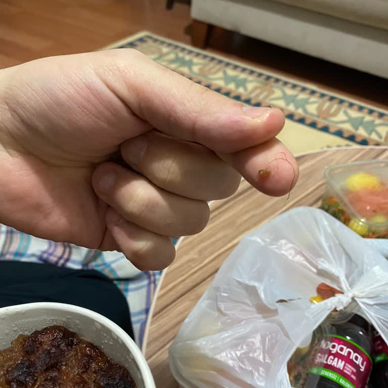 Köfte Siparişinde Kıl Çıkması Ve Yetersiz Müşteri Hizmeti