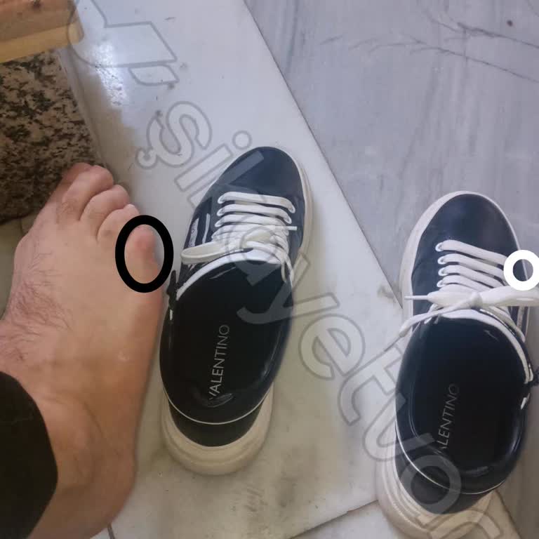 Valentino Ayakkabı Şikayeti