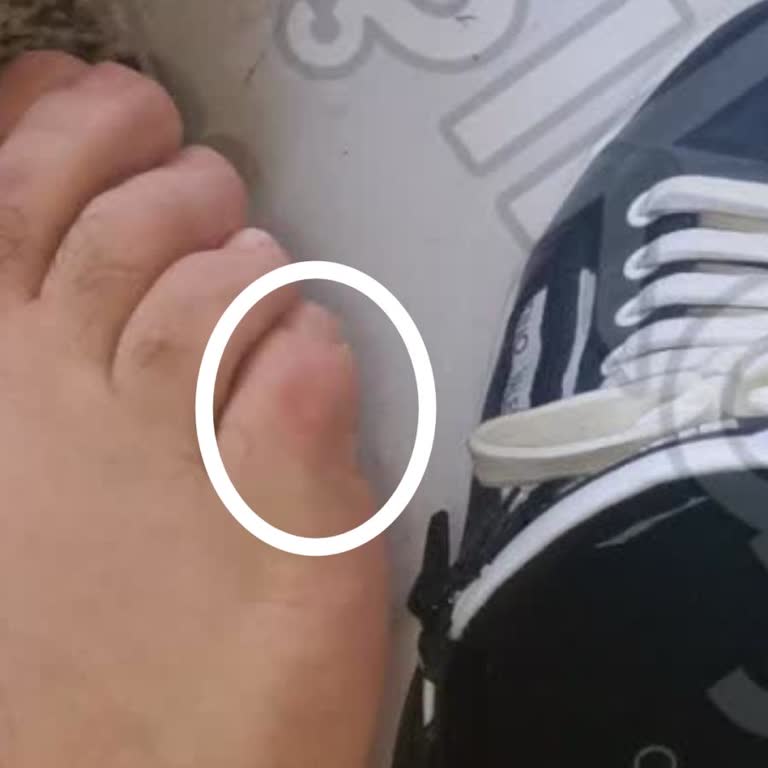 Valentino Ayakkabı Şikayeti